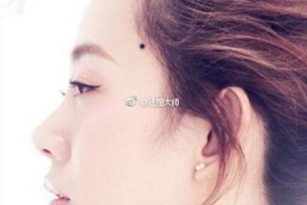 左嘴痣女人：美丽与智慧并存的幸运儿