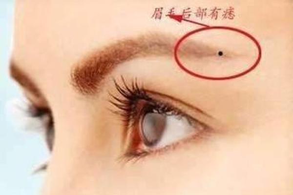 阴部痣相大揭秘：揭秘你的命运密码，快来对号入座！