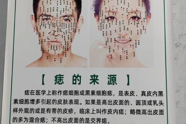 痣相揭秘：女人身上这些痣意味着什么？