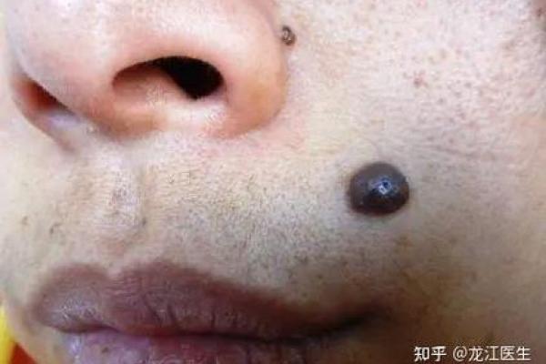 网红小男孩：脸上那颗痣，让他与众不同