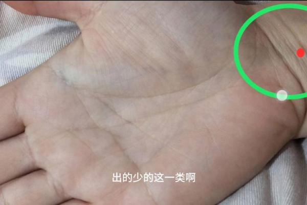 手腕上长痣，运势竟如此惊人！
