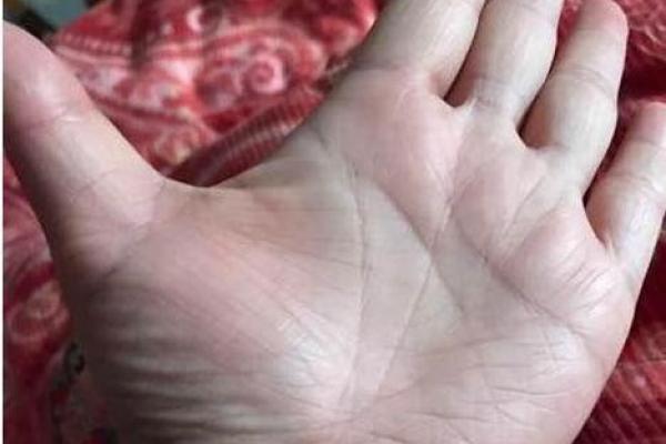 破茧成蝶：穷命人的手相秘密