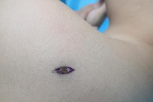肩膀上的神秘印记：揭秘肩痣女子的独特魅力