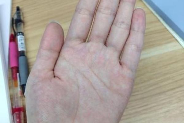 手相揭秘：肾虚症状一览无遗！