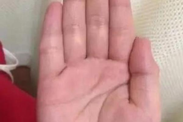 手相揭秘：肾虚症状一览无遗！