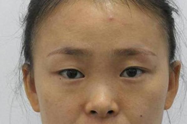 面相揭秘：脸颊塌陷背后的命运启示