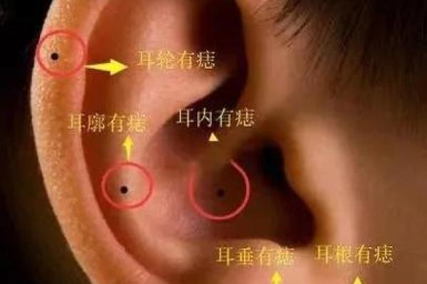耳后神秘痣，女人独特魅力的秘密武器