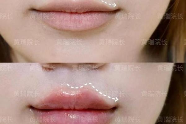 唇型扁平面，揭秘东方美人的独特魅力