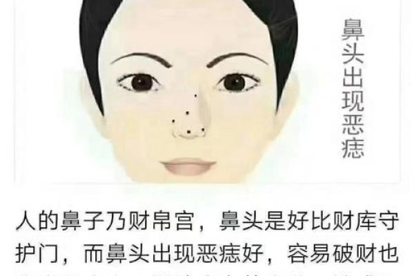 痣相风水学：痣在哪里，财运就在哪里？