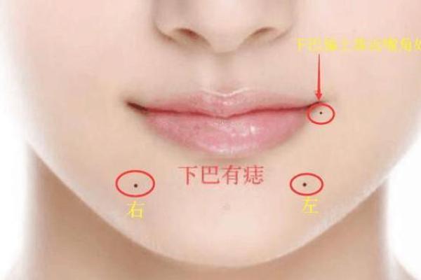 美丽小腹痣，财运亨通的象征！